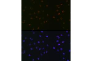 Immunofluorescence analysis of C6 cells using SUPT5H/SPT5 Rabbit mAb (ABIN7270878) at dilution of 1:100 (40x lens). (SUPT5H 抗体)