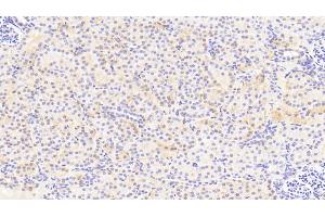 Detection of APOE in Human Kidney Tissue using Polyclonal Antibody to Apolipoprotein E (APOE) (APOE 抗体  (AA 19-181))