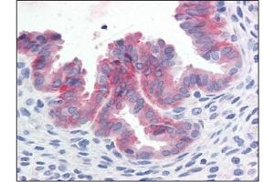 Immunohistochemistry (IHC) image for anti-Met Proto-Oncogene (MET) (Cytoplasmic Domain) antibody (ABIN614469)