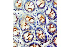 Anti-SSTR1 antibody, IHC(P) IHC(P): Rat Intestine Tissue (SSTR1 抗体  (C-Term))