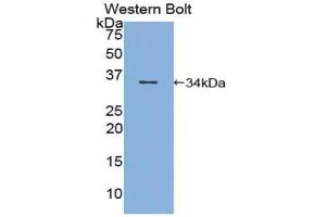 Western blot analysis of the recombinant protein. (Topoisomerase I 抗体  (AA 1-250))