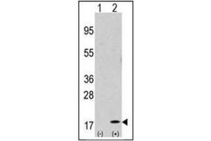 Western blot analysis of GABARAP (arrow) using Autophagy GABARAP Antibody (N-term) Cat.