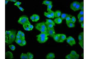 Immunofluorescence staining of HepG2 cells with ABIN7145438 at 1:66, counter-stained with DAPI. (ADRBK2 抗体  (AA 343-480))