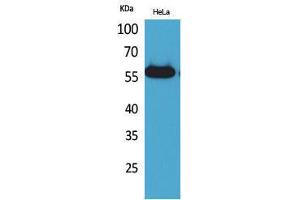 Western Blotting (WB) image for anti-Amylase (AMY) (N-Term) antibody (ABIN3187706) (Amylase 抗体  (N-Term))