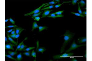 Immunofluorescence of purified MaxPab antibody to PPIA on HeLa cell. (PPIA 抗体  (AA 1-165))