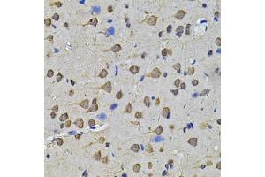 Immunohistochemistry of paraffin-embedded rat brain using N6AMT1 Antibody (ABIN5974334) at dilution of 1/100 (40x lens). (N6AMT1 抗体)
