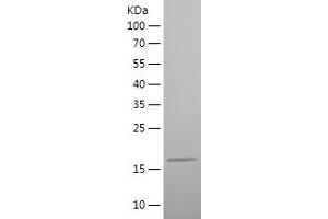 Western Blotting (WB) image for Chemokine (C-X3-C Motif) Ligand 1 (CX3CL1) (AA 76-182) protein (His tag) (ABIN7122345)