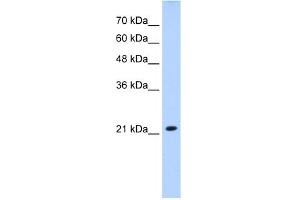 Western Blotting (WB) image for anti-Solute Carrier Family 25 (Mitochondrial Carrier, Brain), Member 14 (SLC25A14) (N-Term) antibody (ABIN2781596)