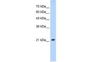 WB Suggested Anti-SLC25A14 Antibody Titration:  2.