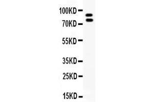 Western blot analysis of MMP-9 expression in NRK whole cell lysates ( Lane 1). (MMP 9 抗体  (C-Term))