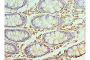 Immunohistochemistry of paraffin-embedded human colon tissue using ABIN7174493 at dilution of 1:100 (UBE2V2 抗体  (AA 1-145))