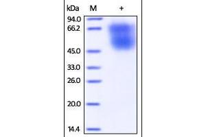 SDS-PAGE (SDS) image for CD86 (CD86) (AA 19-240) protein (His tag) (ABIN2180853)