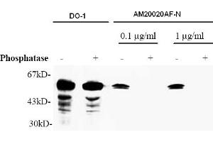 Western Blotting (WB) image for anti-Tumor Protein P53 (TP53) (AA 378-393), (pSer392) antibody (ABIN487475) (p53 抗体  (pSer392))