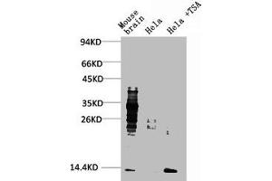 Western blot analysis of 1) Mouse Brain Tissue, 2) Hela, 3) Hela+TSA Treated using Acetyl Lysine Monoclonal Antibody. (Acetylated Lysine 抗体)
