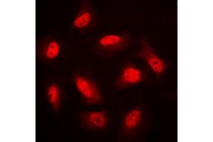 Immunofluorescent analysis of AMPK beta 1 staining in HeLa cells. (PRKAB1 抗体  (N-Term))