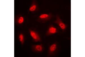 Immunofluorescent analysis of AMPK beta 1 staining in HeLa cells.