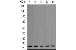 Western blot analysis of PSMB1 expression in MCF7 (A), HepG2 (B), K562 (C), PC3 (D), mouse liver (E) whole cell lysates. (PSMB1 抗体)