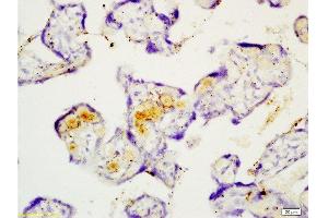 Formalin-fixed and paraffin embedded human placenta tissue with Anti-Fibulin 5 Polyclonal Antibody , Unconjugated at 1:200, followed by conjugation to the secondary antibody and DAB staining (Fibulin 5 抗体  (AA 101-200))