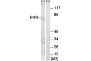 Western blot analysis of extracts from 293 cells, using PKR (Ab-258) Antibody. (EIF2AK2 抗体  (AA 226-275))
