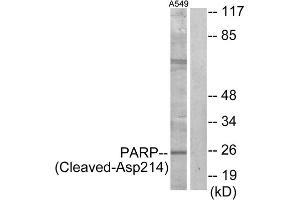 Western blot analysis of extracts from A549 cells, treated with etoposide (25uM, 24hours), using PARP (Cleaved-Asp214) antibody. (PARP1 抗体  (Cleaved-Asp214))