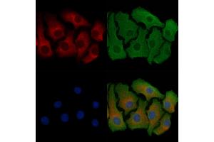 ABIN6257471 and ABIN6274750 staining Hela cells by IF/ICC. (RPS18 抗体  (C-Term))