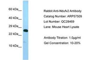 Image no. 1 for anti-NADH Dehydrogenase (Ubiquinone) Flavoprotein 2, 24kDa (NDUFV2) (AA 32-81) antibody (ABIN6749939) (NDUFV2 抗体  (AA 32-81))