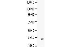 Observed bind size: 23KD (GREM1 抗体  (C-Term))
