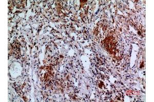 Immunohistochemistry (IHC) analysis of paraffin-embedded Human Lung, antibody was diluted at 1:100. (APAF1 抗体  (Internal Region))