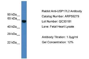 WB Suggested Anti-USP17L2  Antibody Titration: 0.