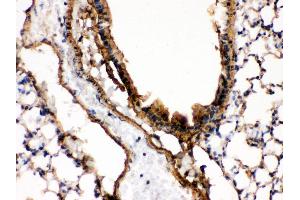 IHC(P): Mouse Lung Tissue (MAP2K7 抗体  (N-Term))