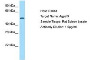 Image no. 1 for anti-1-Acylglycerol-3-Phosphate O-Acyltransferase 9 (AGPAT9) (AA 251-300) antibody (ABIN6749916) (AGPAT9 抗体  (AA 251-300))