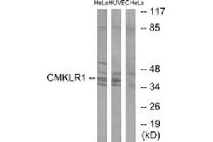 Western blot analysis of extracts from HeLa/HuvEc cells, using CMKLR1 Antibody. (CMKLR1 抗体  (AA 221-270))