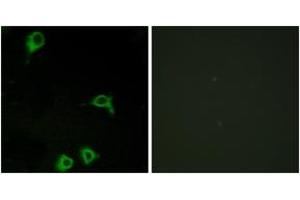Immunofluorescence analysis of COS7 cells, using EMR2 Antibody. (EMR2 抗体  (AA 765-814))