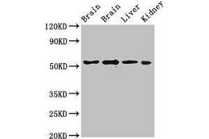Western Blot Positive WB detected in: Rat brain tissue, Mouse brain tissue, Mouse liver tissue, Mouse kidney tissue All lanes: PPP2R2A antibody at 3 μg/mL Secondary Goat polyclonal to rabbit IgG at 1/50000 dilution Predicted band size: 52, 53 kDa Observed band size: 52 kDa (PPP2R2A 抗体  (Regulatory Subunit B))