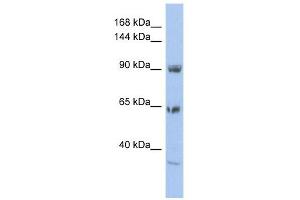 TPCN1 antibody used at 1 ug/ml to detect target protein. (TPCN1 抗体  (N-Term))