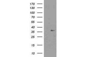 Western Blotting (WB) image for anti-Nudix (Nucleoside Diphosphate Linked Moiety X)-Type Motif 6 (NUDT6) antibody (ABIN1499867) (NUDT6 抗体)