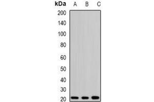 Western blot analysis of H-Ras expression in SKOV3 (A), mouse kidney (B), rat brain (C) whole cell lysates. (HRAS 抗体)