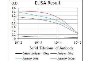 Black line: Control Antigen (100 ng), Purple line: Antigen(10 ng), Blue line: Antigen (50 ng), Red line: Antigen (100 ng), (Cytokeratin 5 抗体)