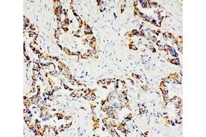 IHC-P: Paxillin antibody testing of human lung cancer tissue