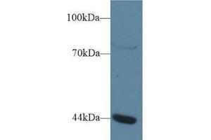 Western blot analysis of Human Jurkat cell lysate, using Human GTF3A Antibody (1 µg/ml) and HRP-conjugated Goat Anti-Rabbit antibody ( (GTF3A 抗体  (AA 71-365))