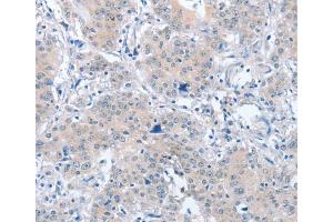 Immunohistochemistry (IHC) image for anti-Par-6 Partitioning Defective 6 Homolog alpha (PARD6A) antibody (ABIN2428552) (PARD6A 抗体)
