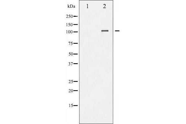 NFATC3 抗体  (pSer165)
