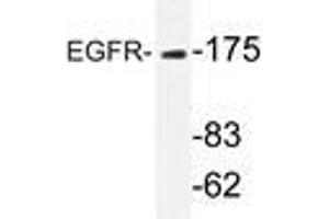 Western blot analyzes of EGFR antibody in extracts from HeLa cells. (EGFR 抗体)