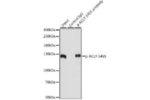 Immunoprecipitation (IP) image for anti-ATP Citrate Lyase (ACLY) (pSer455) antibody (ABIN6136002)
