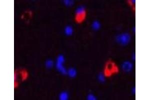 Immunofluorescence (IF) image for anti-Microtubule-Associated Protein 2 (MAP2) antibody (ABIN7250104)