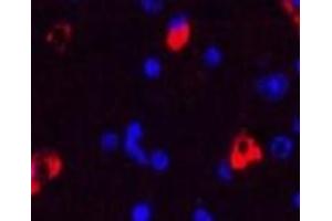 Immunofluorescence analysis of Mouse brain tissue using MAP2 Monoclonal Antibody at dilution of 1:200. (MAP2 抗体)