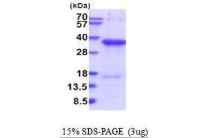 SDS-PAGE (SDS) image for MHC Class I Polypeptide-Related Sequence A (MICA) (AA 24-297) protein (His tag) (ABIN7280944) (MICA Protein (AA 24-297) (His tag))