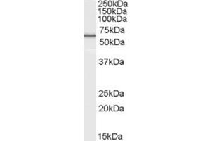 Image no. 2 for anti-V-Set Domain Containing T Cell Activation Inhibitor 1 (VTCN1) (Internal Region) antibody (ABIN334524)