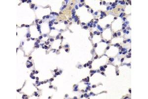 Immunohistochemistry of paraffin-embedded Mouse lung using INTS6 Polyclonal Antibody at dilution of 1:100 (40x lens). (INTS6 抗体)