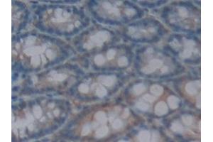 Immunohistochemistry (IHC) image for anti-Interleukin 1 delta (FIL1d) (AA 1-156) antibody (ABIN7442798)